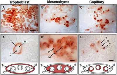 Placental Vascular Calcification and Cardiovascular Health: It Is Time to Determine How Much of Maternal and Offspring Health Is Written in Stone